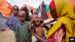 Maryan Madey, who fled the drought-stricken Lower Shabelle region, holds her malnourished daughter Deka Ali, 1, at a camp for the displaced on the outskirts of Mogadishu, Somalia, Sept. 3, 2022. 