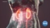 የኩላሊት ጤና