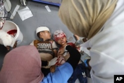 Arhiv - Palestinska djeca ranjena u izraelskom bombardovanju Pojasa Gaze bivaju zbrinuta u bolnici Al Aqsa, u Deir al Balahu, 9. juna 2024.
