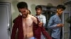 دو روزنامه‌ نگاری توسط طالبان لت و کوب شده بودند (تصویر از آرشیف صدای امریکا)