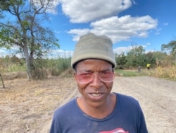 Tafadzwa Gamanya from Goromonzi district is one of the Zimbabweans living in rural areas who are doing better than their counterparts in the urban areas thanks to subsistence farming and good rains. (Columbus Mavhunga/VOA)
