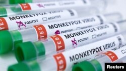 FILE - Tubes labeled with monkeypox test results are seen in this illustration made May 23, 2022.
