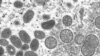 WHO Meeting on Monkeypox Outbreak, Disease Name Change 
