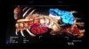 Virtual Medicine Takes Shape with Floating Body Parts