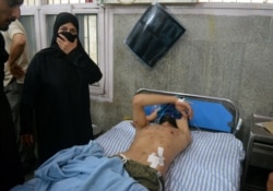 A man with pellet injuries lies in a hospital bed after he was injured during clashes between the Indian police and protesters in Srinagar Aug. 9, 2019.