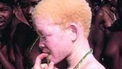 Moise Nkengurutse joint par Eric Manirakiza