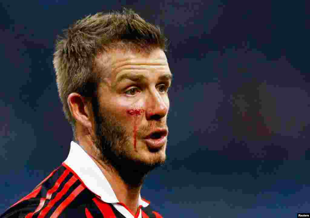 David Beckham post-injury during the Italian serie A soccer match against Chievo in Milan, March 14, 2010. 