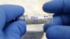 US Launches Experimental Zika Vaccine Clinical Trials