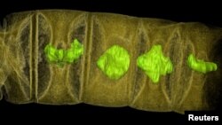 An X-ray tomographic picture of fossil thread-like red algae, tinted to show detail, unearthed in central India may represent the oldest-known plants on Earth, dating from 1.6 billion years ago, according to research published in the journal PLOS Biology. (Courtesy: Stefan Bengtson)