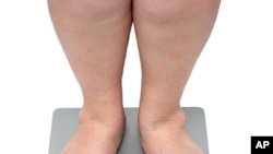 Research in gastric bypass surgery could lead to new treatments for diabetes.