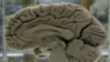 Caffeine and Mental Exercises Improve Memory