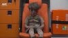 Photo of Boy Injured in Syria Airstrike Goes Viral 