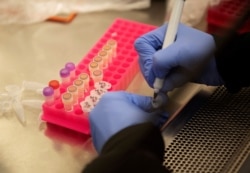 FILE: Researchers work with coronavirus samples as a trial begins to see whether malaria treatment hydroxychloroquine can prevent or reduce the severity of the coronavirus disease, at the University of Minnesota in Minneapolis, March 19, 2020.