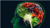 Brain food