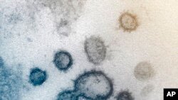 This undated electron microscope image made available by the U.S. National Institutes of Health in February 2020 shows the Novel Coronavirus SARS-CoV-2. Also known as 2019-nCoV, the virus causes COVID-19. The sample was isolated from a patient in…