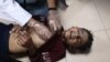 Povrijeđeni palestinski dječak dobija liječničku pomoć u bolnici za mučenike Al-Aksa nakon što je izraelski napad pogodio školu u kojoj se nalaze raseljeni ljudi u Deir al-Balahu u centralnom pojasu Gaze 10. oktobra 2024. godine.