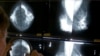 Studies: Cancer Can Spread Undetected, Before Tumor Develops