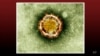 What are coronaviruses?