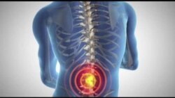 HLSpinalQ1