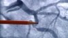 Research: Fish Oil May Slow Aging of Heart